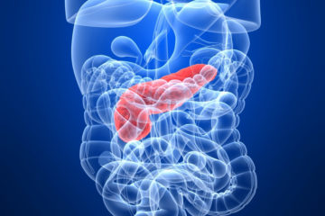 pancreatite cronica